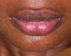 LB lips2.JPG‎