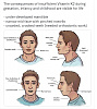 Vitamin-K2-Deficiency-Consequences.jpg‎